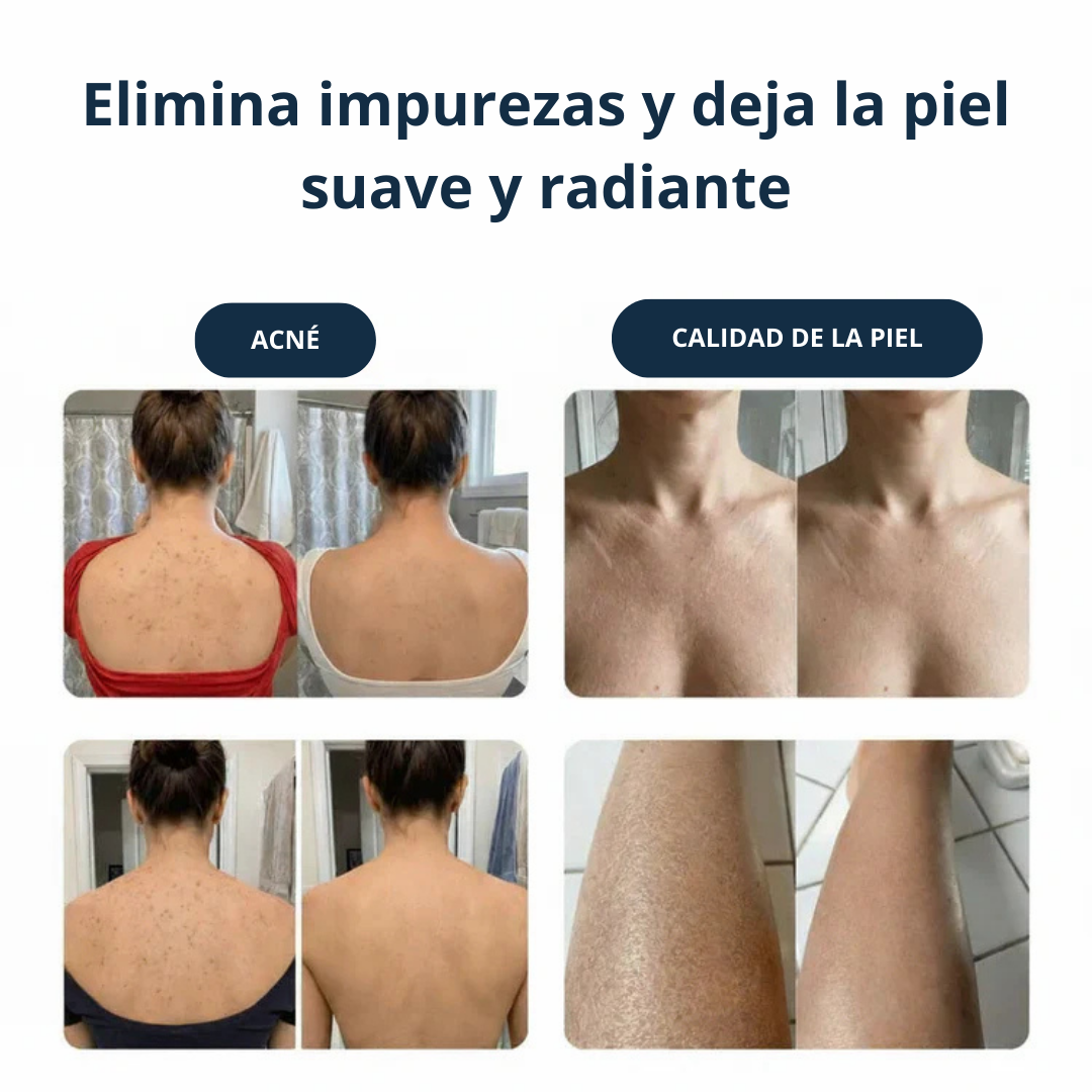 Skinova&co - Exfoliante antibacteriana para ducha