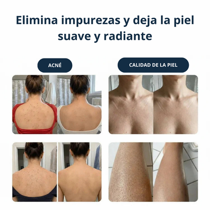 Skinova&co - Exfoliante antibacteriana para ducha
